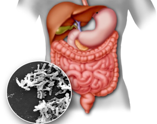 Пищевая токсикоинфекция