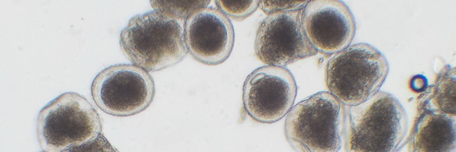Препараты против гельминтов. Лечение от глистов