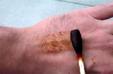 Роль йода в организме человека