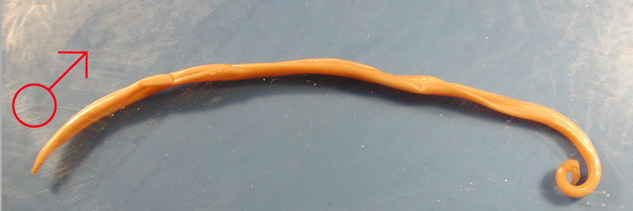 Аскаридоз у детей и взрослых – симптомы и лечение