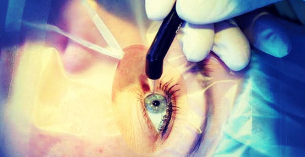 Лазерная коррекция: осложнения