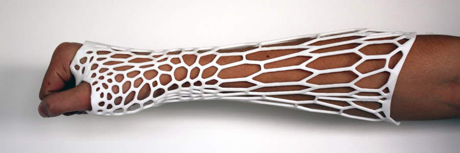 Лікування переломів