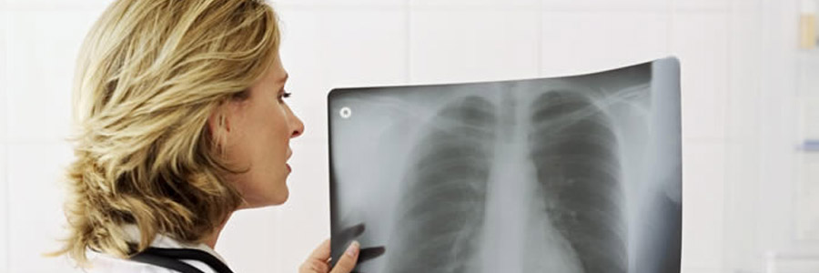 Пневмония - причины, симптомы, лечение