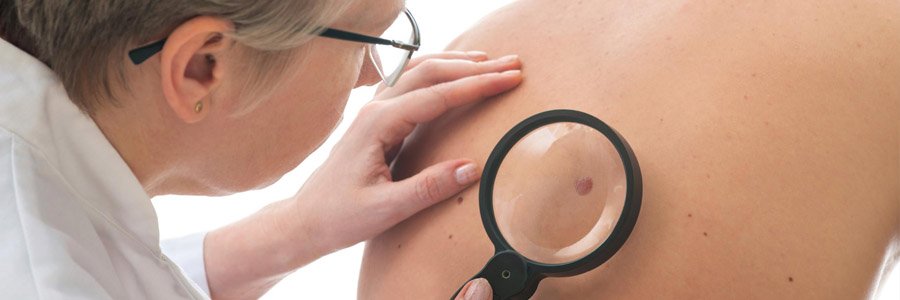 рак, карцинома