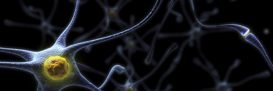 Рассеянный склероз